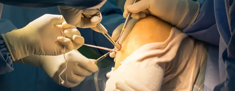 on-capraz-bag-yaralanmalari-sik-sorulan-sorular